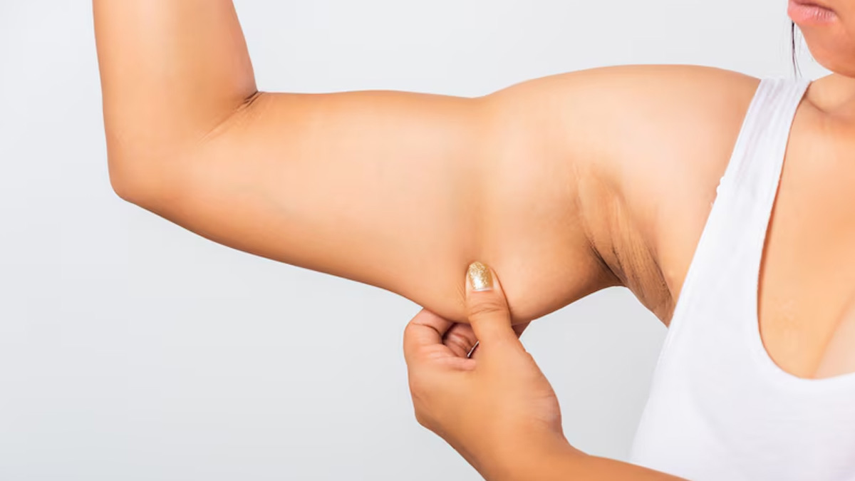 Can Arm Fat Lead To Spinal Fracture? Ways To Reduce It